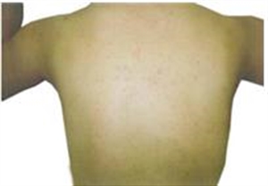 シーズ・ラボのメディカルエステ