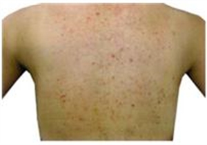 シーズ・ラボのメディカルエステ